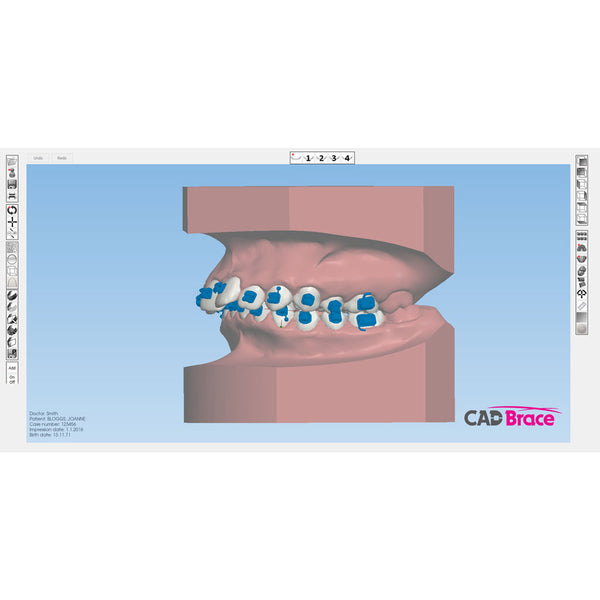 CAD BRACE PLUS+ Upper and Lower with Brackets Supplied