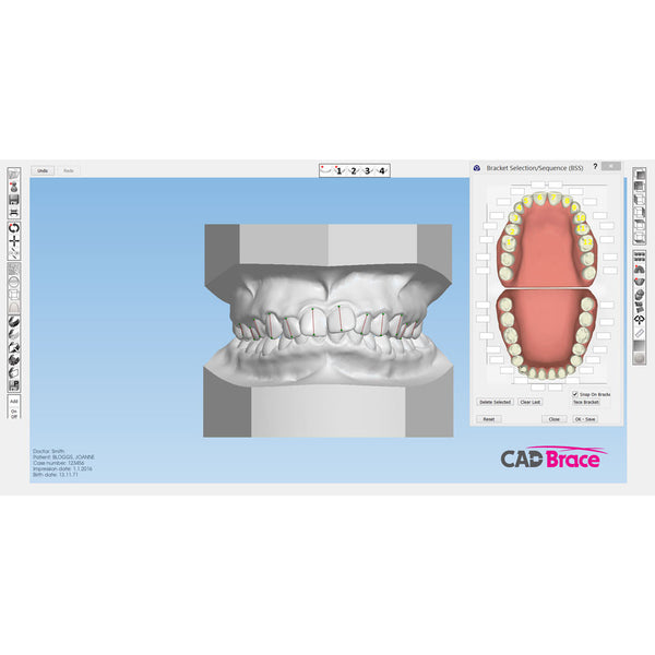 CAD BRACE PLUS+ Upper and Lower with Brackets Supplied