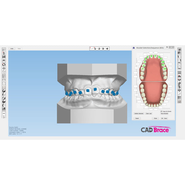 CAD BRACE PLUS+ Upper and Lower with Brackets Supplied