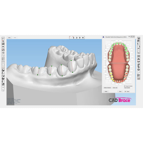 CAD BRACE PLUS+ Upper and Lower with Brackets Supplied
