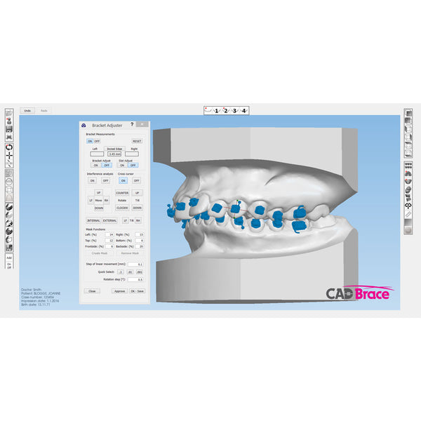 CAD BRACE PLUS+ Upper and Lower with Brackets Supplied