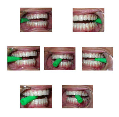 ALIGNER CHEWIES - SEAT YOUR ALIGNERS