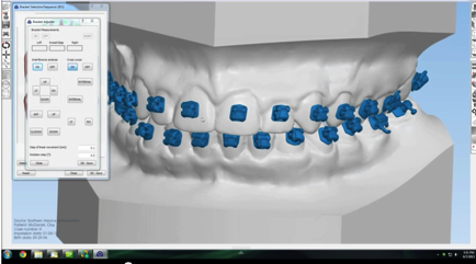 CAD BRACE SOFTWARE TRAINING