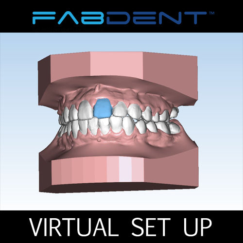 VIRTUAL SET UP - For Aligners