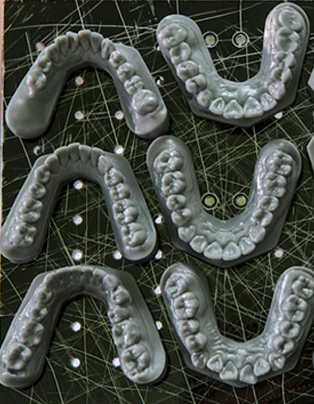 3D Print Aligner Model Service