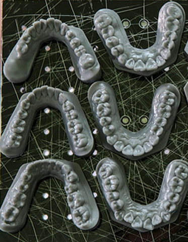 3D Print Aligner Model Service
