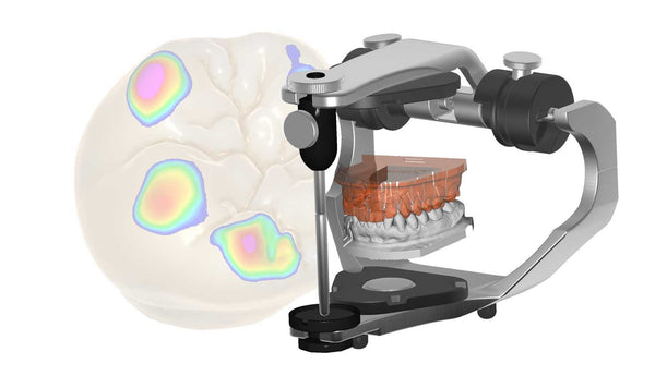 exocad add on module - Virtual Articulator Module