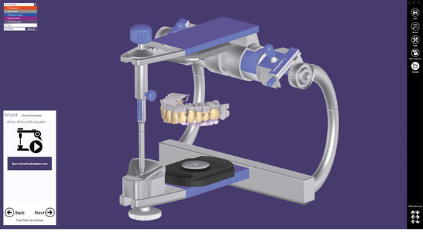 exocad add on module - Virtual Articulator Module