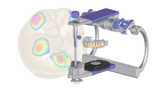 exocad add on module - Virtual Articulator Module