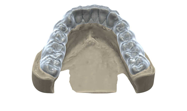 exocad  Bite Spint Module
