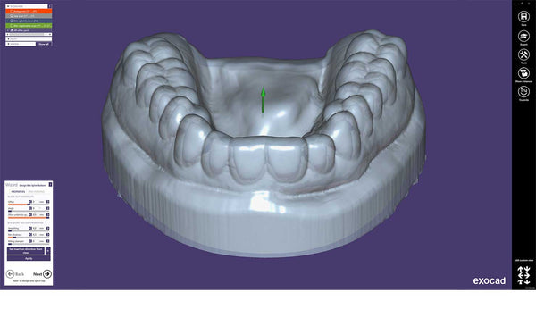exocad  Bite Spint Module