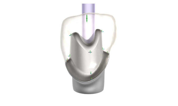 exocad add on module - Implant module