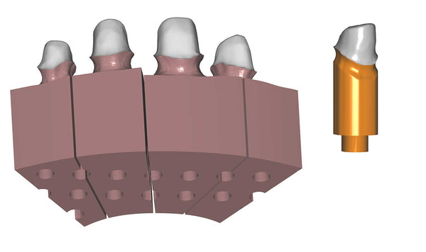 exocad add on module - Model Creator