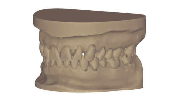 exocad add on module - Model Creator