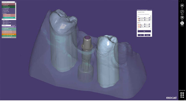 exocad add on module - Model Creator