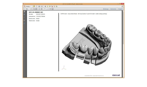 exocad  Standard Core LAB Module 3.2 AI NEW VERSION !