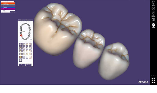 exocad  Tru Smile Module