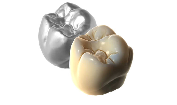 exocad  Tru Smile Module