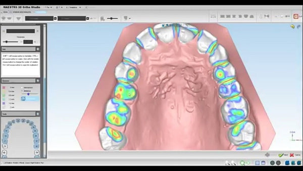 Maestro 3D Ortho Studio Version 4.0 Virtual Setup Module