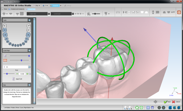 Maestro 3D Ortho Studio Version 4.0 Virtual Setup Module