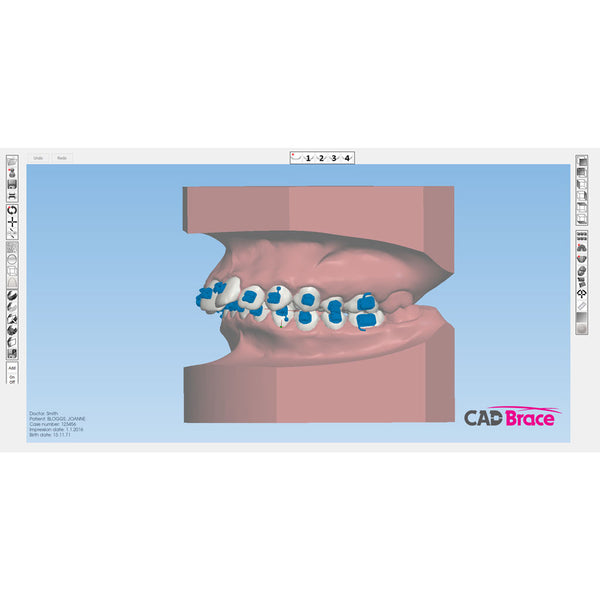 CAD BRACE Upper and Lower (You supply brackets)