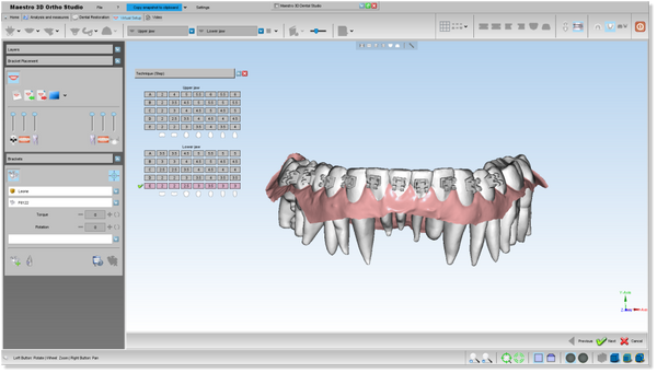 Maestro 3D Ortho Studio Version 4.0 Brackets Placement Module