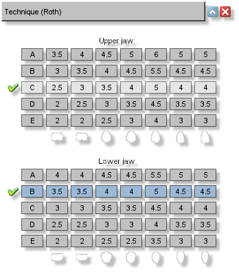 Maestro 3D Ortho Studio Version 4.0 Brackets Placement Module