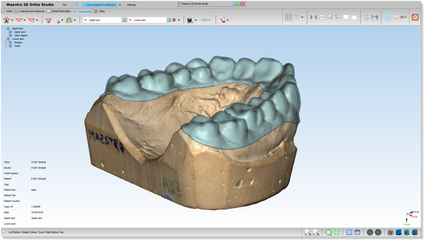 Maestro 3D Ortho Studio Version 4.0 Clear Aligner Module