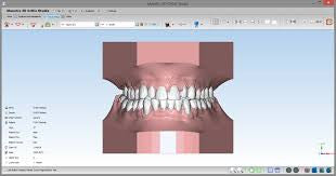 Maestro 3D Ortho Studio Version 4.0 Virtual Setup Module