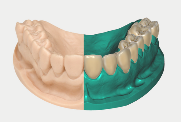 exocad Smile Creator NEW !