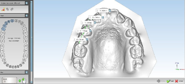 Maestro 3D  Ortho Studio Software Version 5.2