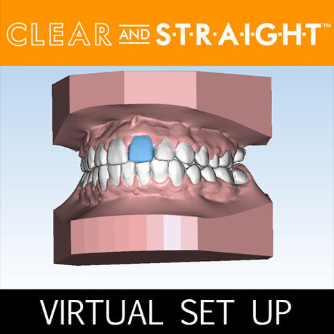 VIRTUAL SET UP - Clear and Straight