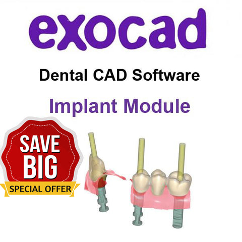 exocad add on module - Implant module