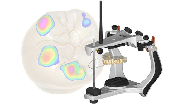 exocad add on module - Virtual Articulator Module