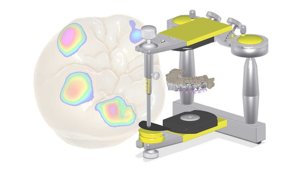 exocad add on module - Virtual Articulator Module