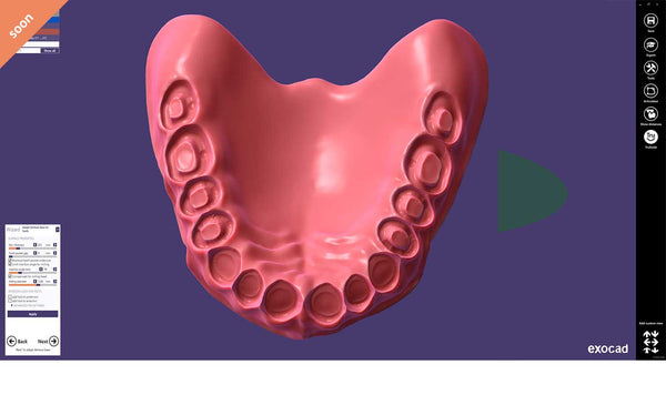 exocad add on module - Full Denture Module