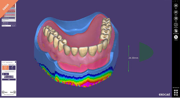 exocad add on module - Full Denture Module