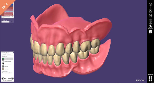 exocad add on module - Full Denture Module