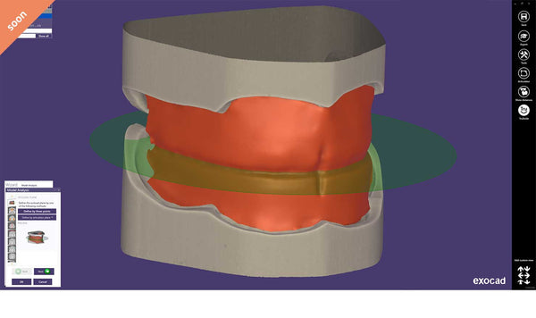 exocad add on module - Full Denture Module