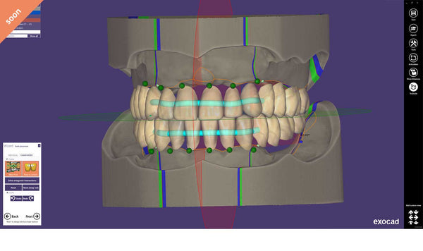 exocad add on module - Full Denture Module