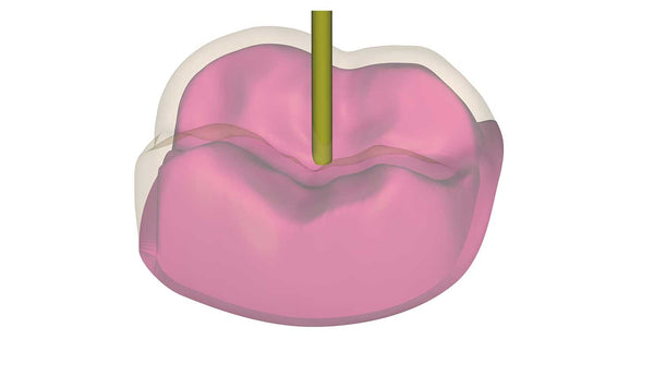 exocad add on module - Provisional Module